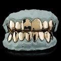 Custom Gold Grillz- Bottom